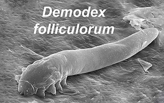 Demodex Mites: Linking Them to Chronic Dry Eye Issues